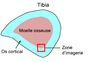 Figure 1 : Coupe transversale d’un tibia de souris