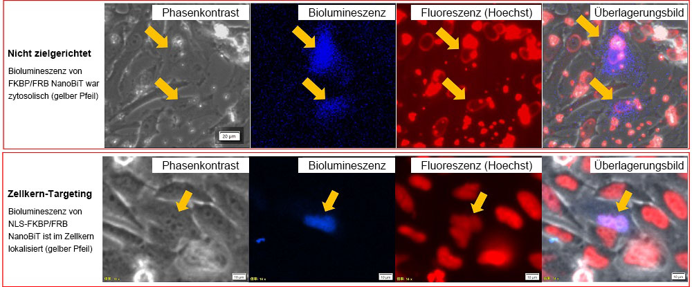 Abbildung 3: Intrazelluläre Lokalisierung von FKBP/FRB NanoBiT und NLS-FKBP/FRB NanoBiT.