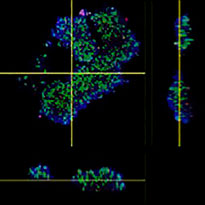 Antibody drug   volume recognition