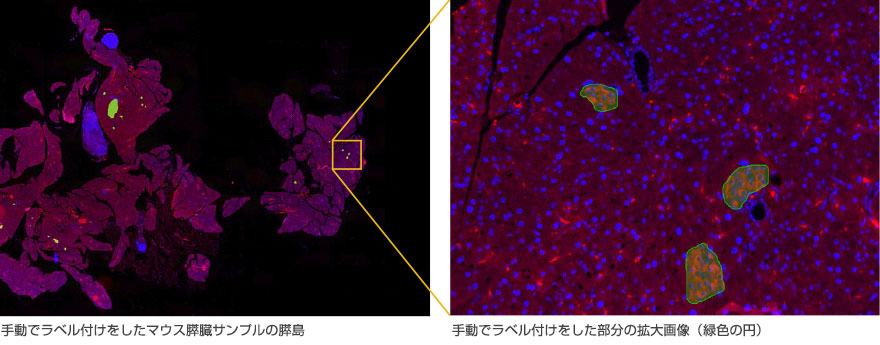 手動でラベル付けをしたマウス膵臓サンプルの膵島、手動でラベル付けをした部分の拡大画像（緑色の円）