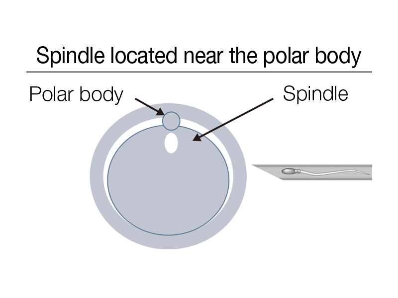 Spindle located near the polar body