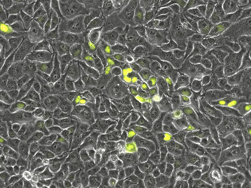 HeLa cells expressing in YFP in cell nuclei