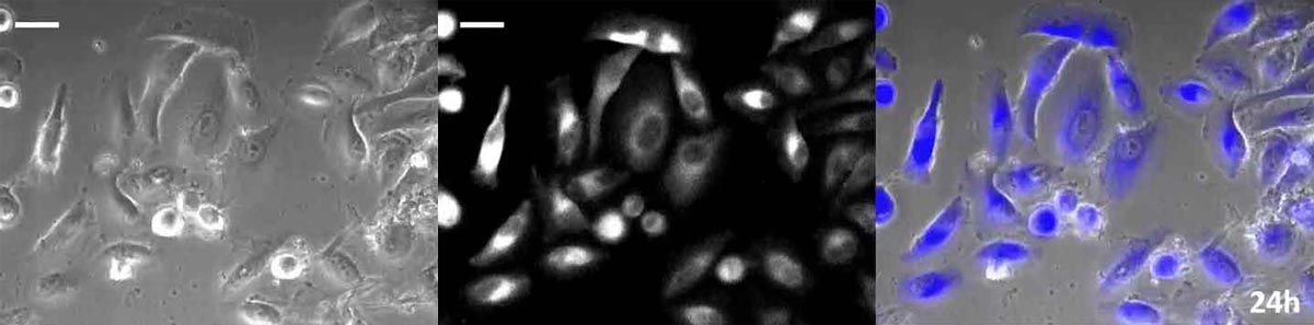 Langzeitbeobachtung mit Tischinkubator (24 Stunden: Phasenkontrast/Lumineszenz/Überlagerung). Probe: HeLa-Zellen mit Expression einer gelb-verstärkten Nano-Lantern (Schale mit Glasboden, 35 mm).