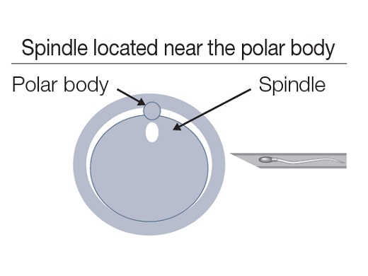 Image of polar body and spindle