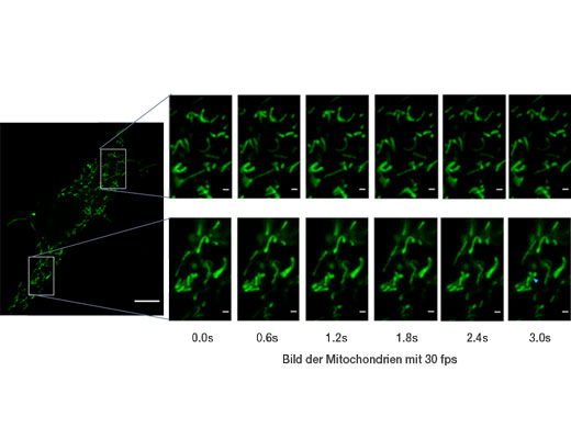 Mitochondrien, markiert durch GFP. Aufgenommen mit 30 fps, die einzelnen Mitochondrienbewegungen sind erkennbar.