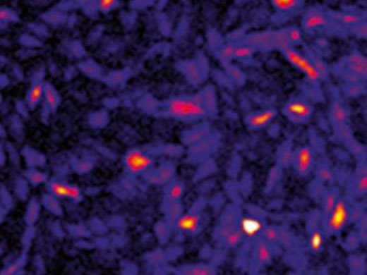 Fibroblastos de ratón NIH3T3