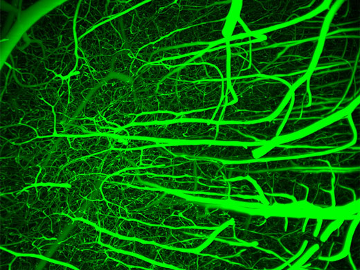 Système vasculaire du cerveau d’une souris, reproduction avec l’aimable autorisation des Dr. Beth Friedman et Hannah Liechty, Kleinfield Laboratory UC San Diego.
