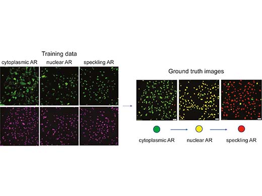 핵 염색에 기반한 다계층 AR 표현형 훈련 데이터 준비. (왼쪽) 녹색: AR-GFP, 보라색: SiR-DNA. (오른쪽) 실측 자료 데이터 세트의 평가.