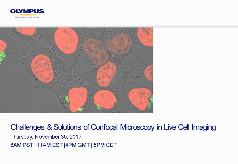 Challenges Solutions of Confocal Microscopy in Live Cell Imaging