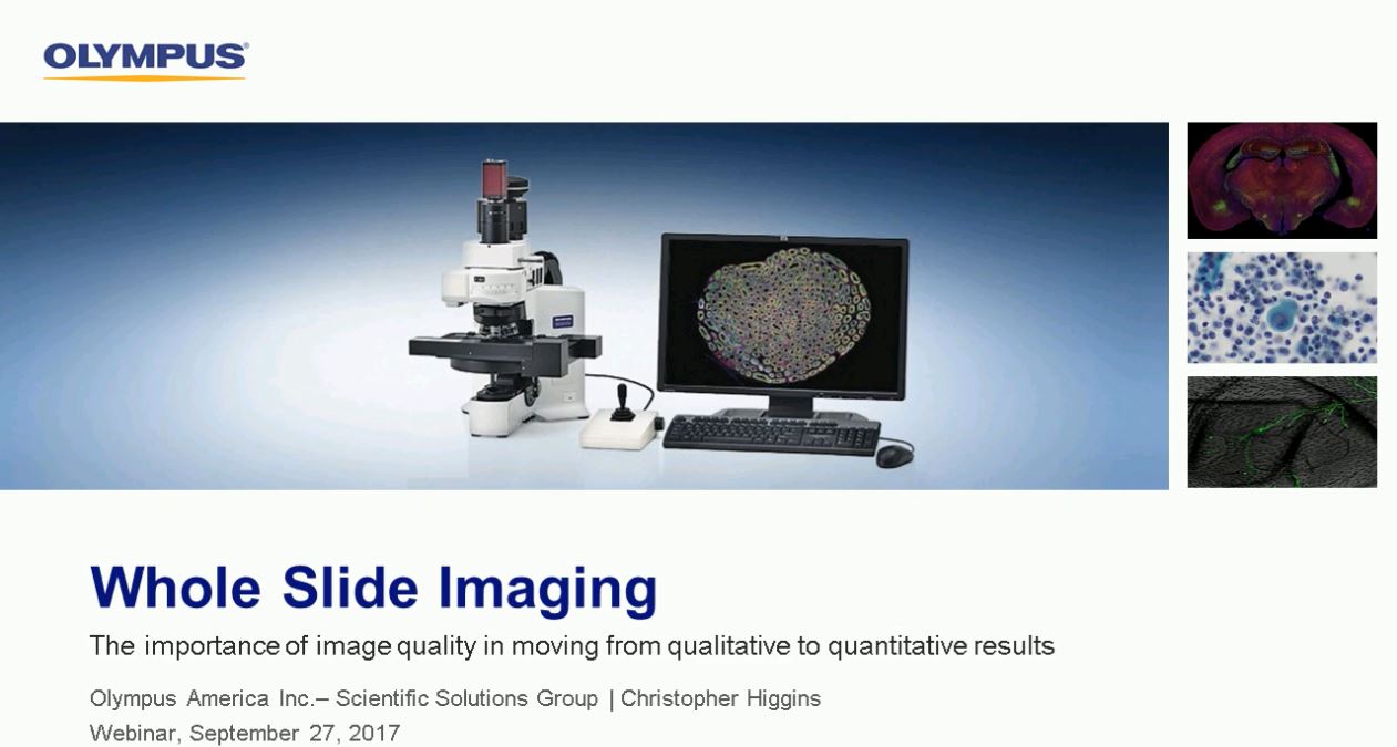 Whole Slide Imaging: The Importance of Image Quality in Moving from Qualitative to Quantitative Results