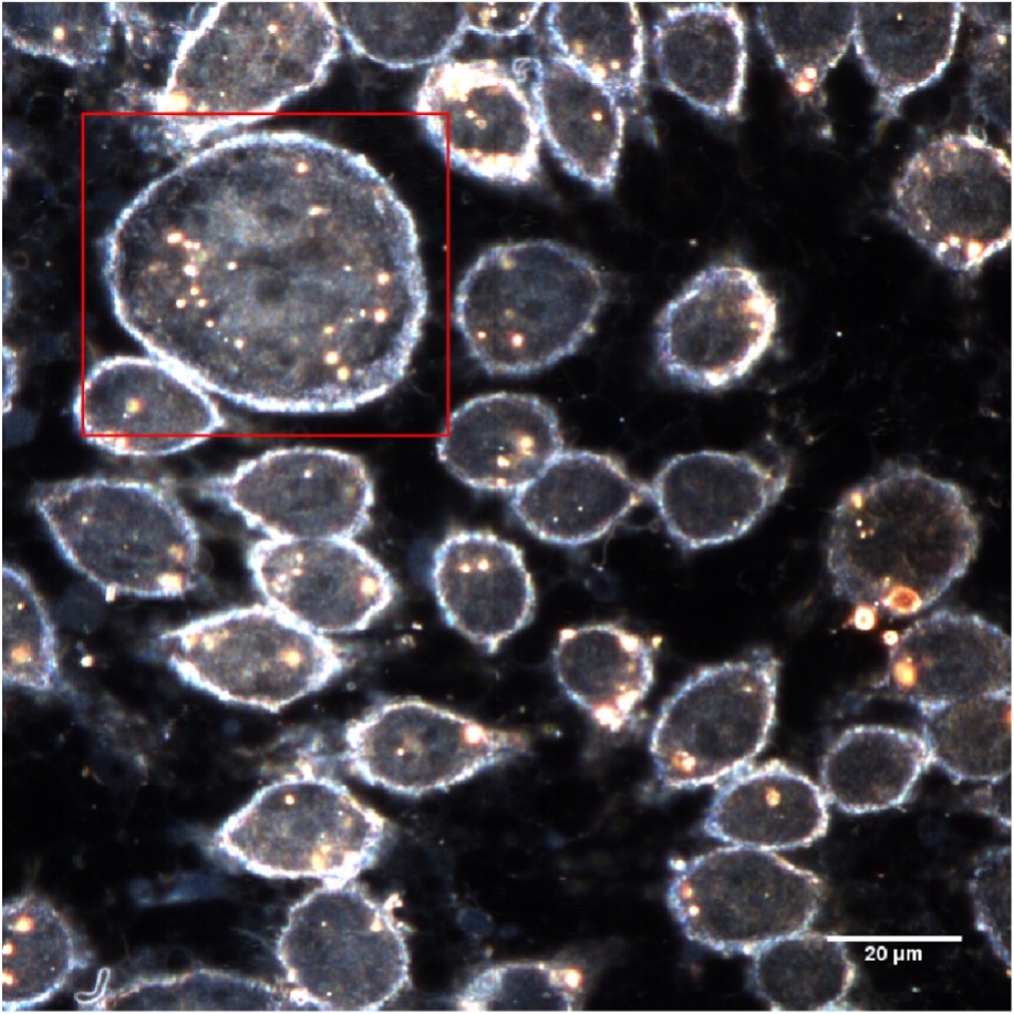 Enhanced darkfield microscopy image of macrophage cells