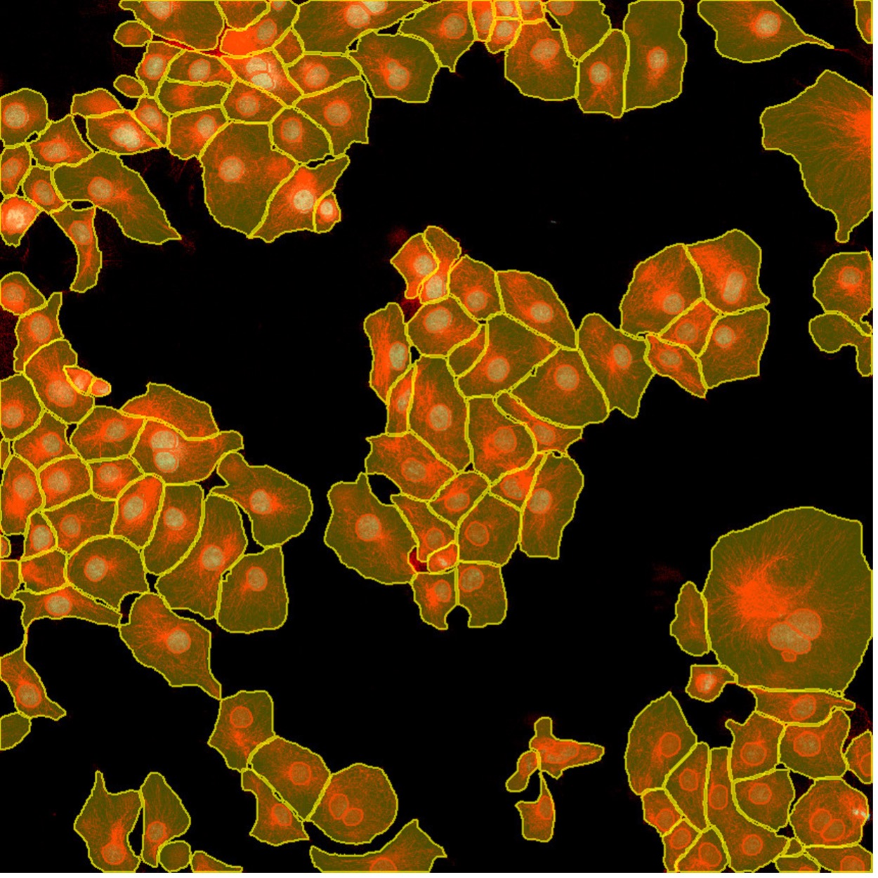 Instance Segmentation Of Cells And Nuclei Made Simple Using Deep ...