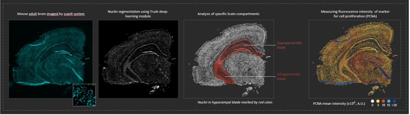 Image analysis of individual cells in mouse adult brain using AI deep learning technology