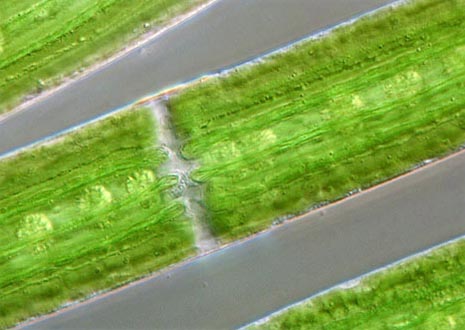 Desmid Algae