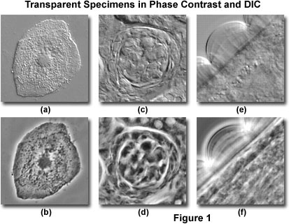 Differential Interference Contrast - Comparison Contrast and DIC Microscopy | Olympus LS