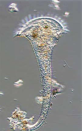 Stentor Protozoan (Trumpet Mode)
