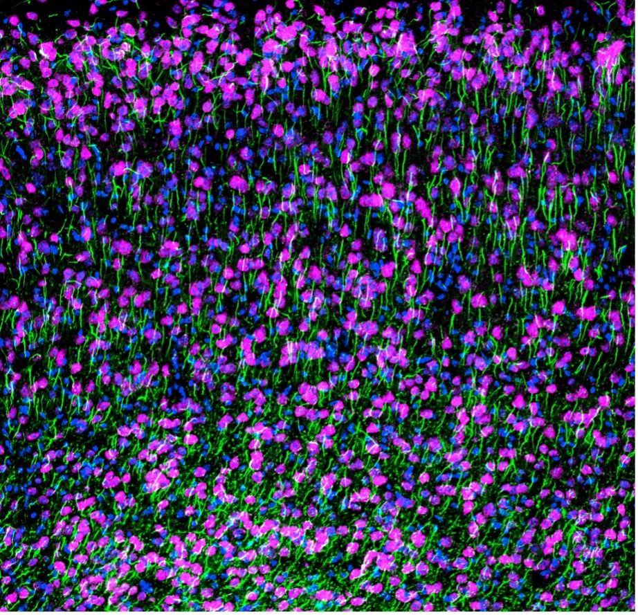 染色したマウス大脳皮質の共焦点画像