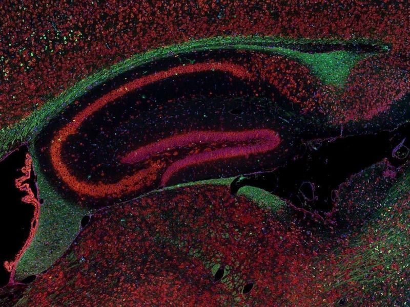 Fluorescence imaging of a mouse brain