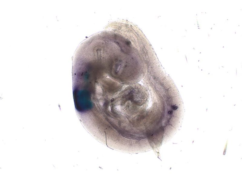 Patrón de expresión Cyp26b1 en un embrión de ratón E9.5 por medio de un completo soporte de hibridación in situ.