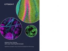 Advance Your Science with Laser Scanning Microscopes: Application Examples Using Confocal and Multiphoton Microscopy