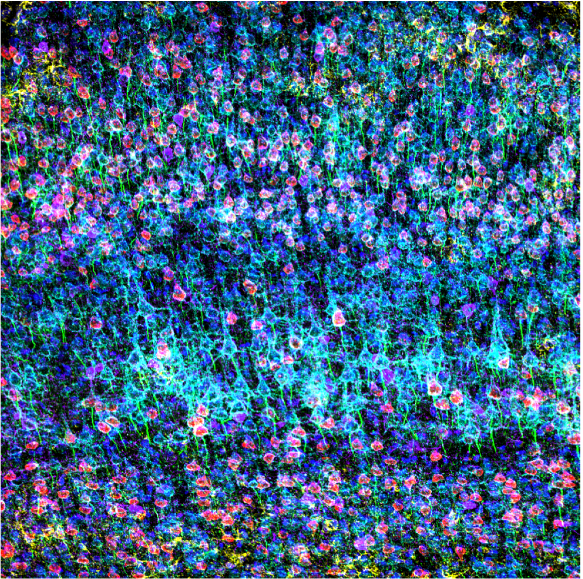 染色したマウス前頭前皮質の共焦点画像