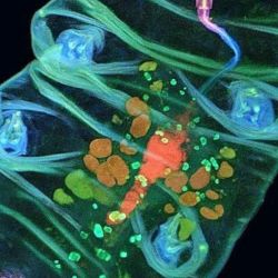 Tardigrade under the microscope