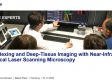 Multiplexação e imagens de tecidos profundos com microscopia de varredura a laser confocal no infravermelho próximo