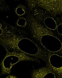 Células HeLa bajo el microscopio