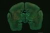 Observation des structures neurales entre le cortex et le thalamus dans le cerveau du marmouset à l’aide du FLUOVIEW FV3000