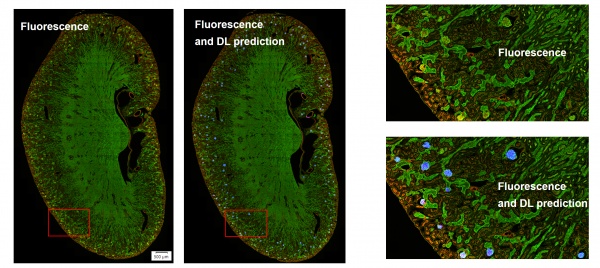 artificial intelligence software for microscopy