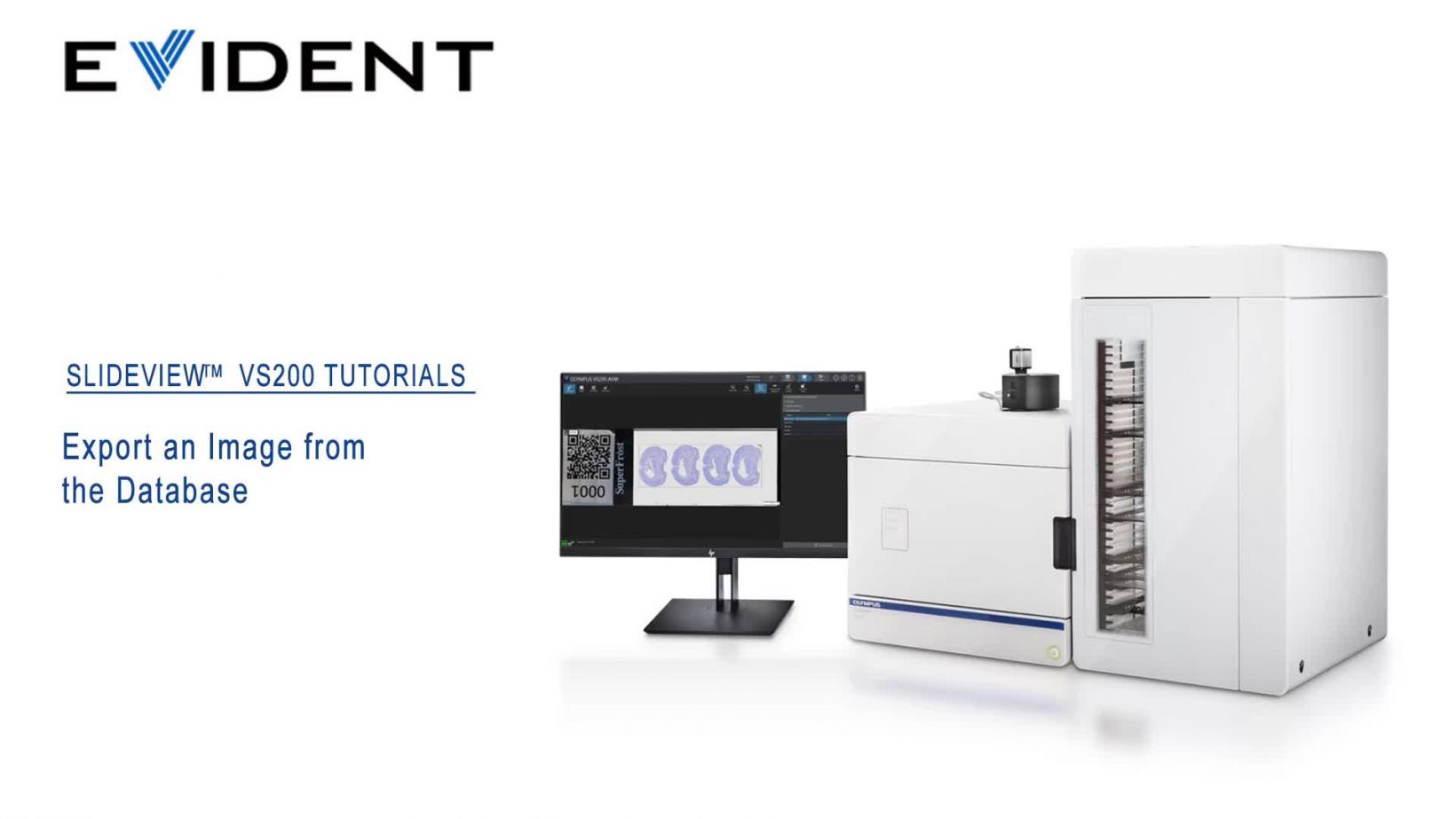 https://static1.olympus-lifescience.com/modules/imageresizer/3fa/6f4/cb3547d447/1640x923p960x540.jpg