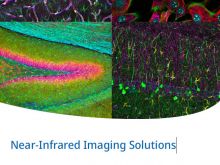 Near-Infrared Imaging Solutions