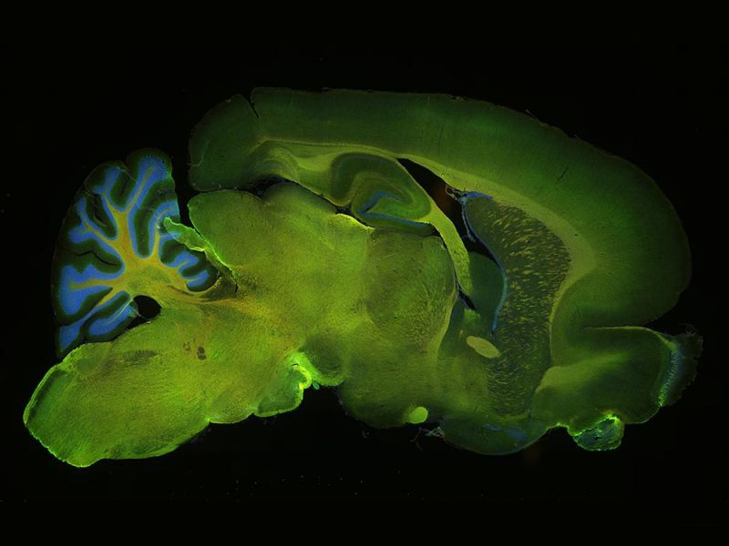 Imagem de aplicação do cérebro de camundongo transversal