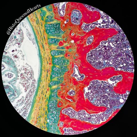 Igelstachel unter dem Mikroskop