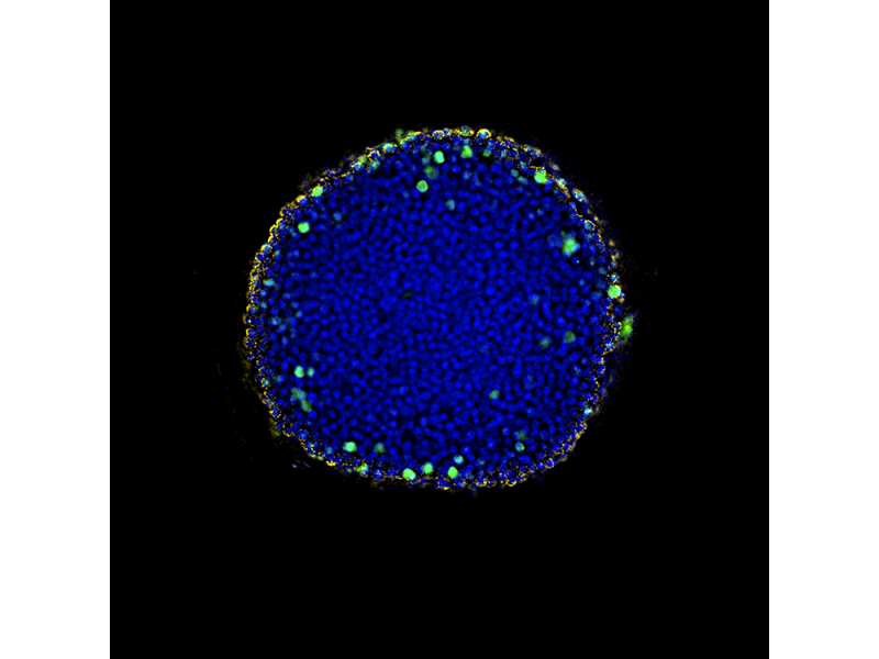 투명해진 HeLa 세포 스페로이드의 적용 이미지