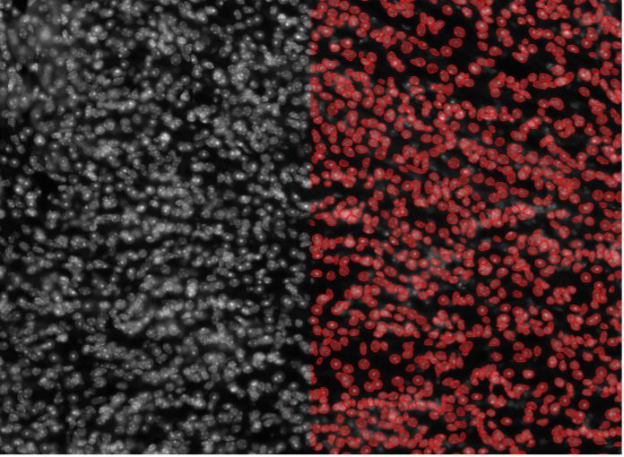 Deep learning image segmentation of mouse kidney tissue cells
