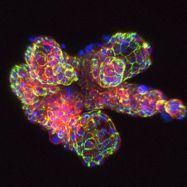 Organoid and 3D Imaging