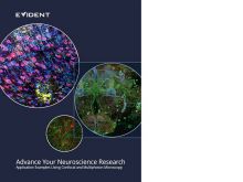 Advance Your Neuroscience Research: Application Examples Using Confocal and Multiphoton Microscopy