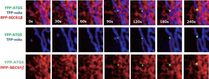 The world’s first dynamic observation of autophagosomes formation from net-like mitochondria (RFP-SEC61β, red) and endoplasmic reticulum (TFP-mito, blue) contact sites.