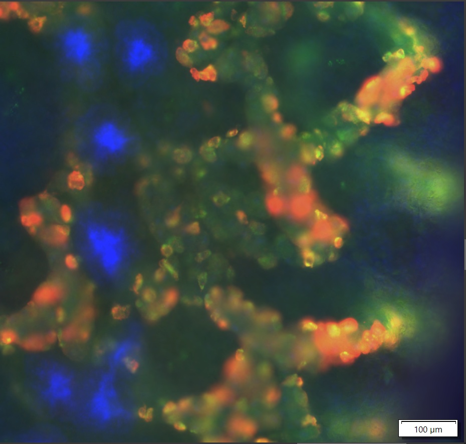S. mediterranea stained with double fluorescent (red and green) in situ hybridization and scanned at 10X magnification virtual Z-stack containing 31 planes.