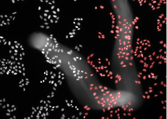 HeLa細胞のディープラーニング画像セグメンテーション