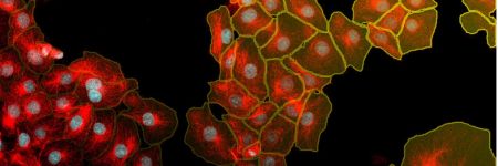 Instanzsegmentierung von Zellkernen und Zellen mit Deep Learning