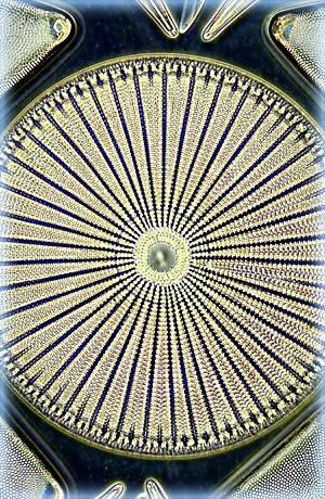 imagerie en fond noir d’une diatomée Arachnoidiscus ehrenbergi