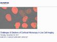 Challenges & Solutions of Confocal Microscopy in Live Cell Imaging
