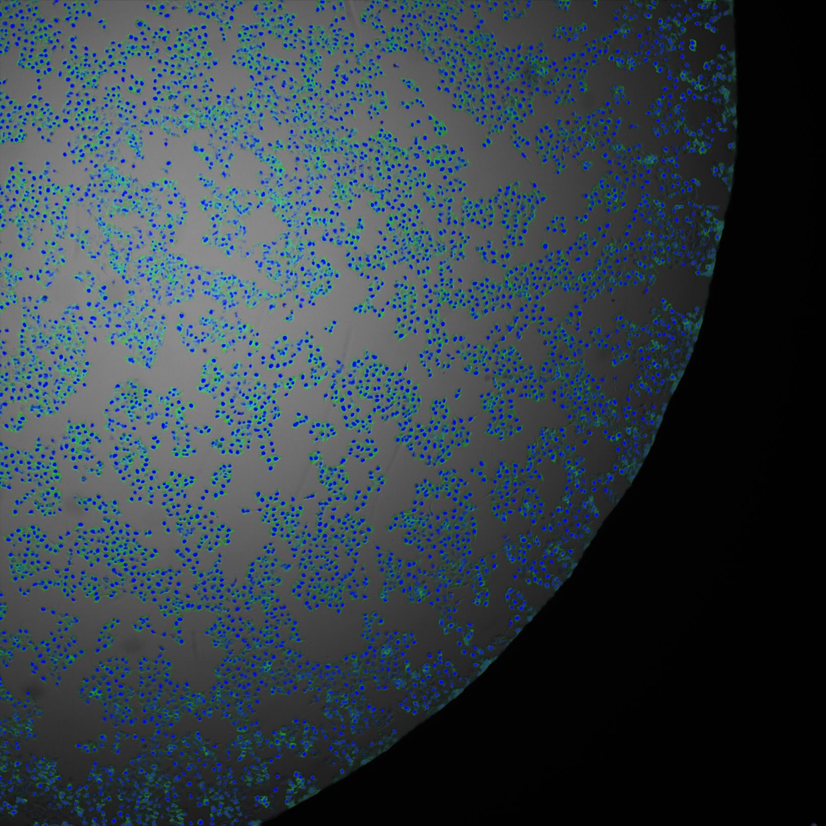 TruAI prediction of the position of cells in a well plate based on a low-contrast brightfield image