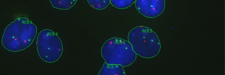 Bildschirmfoto von blauen Kernen und roten und grünen Foci, die in der Zähl- und Messlösung der cellSens Dimension Bildanalysesoftware zur Erfassung von Mikroskopbildern als interessante Regionen markiert sind.