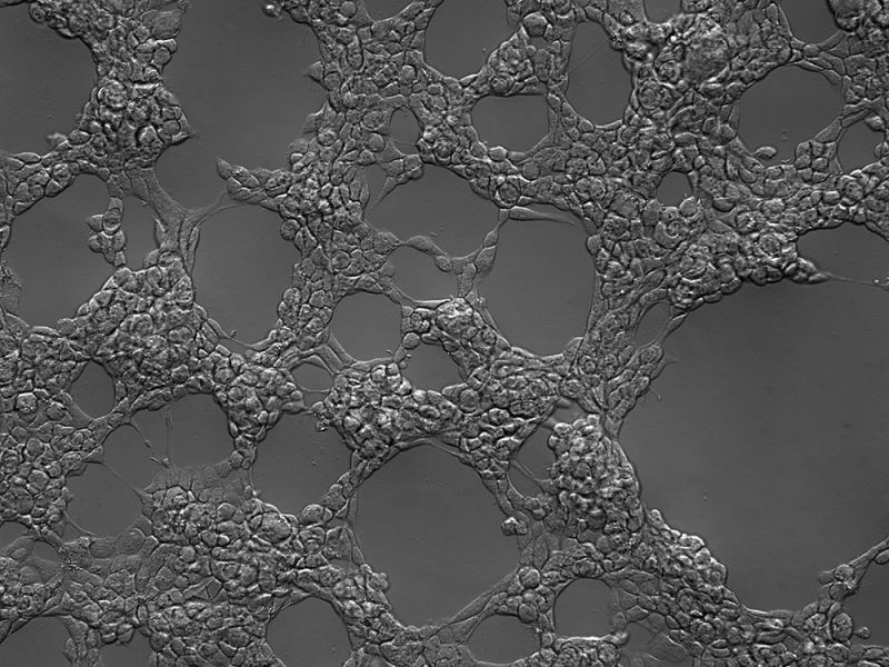 Gradient contrast sample: HEK-293 cells