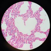 Poumon de chèvre observé au microscope