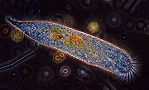 Ciliate under the microscope