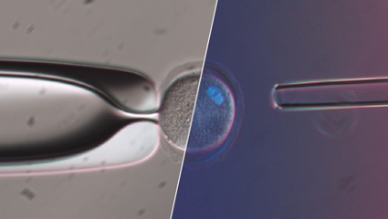 How Polarized Light Can Assist Embryologists in Clinical Routines